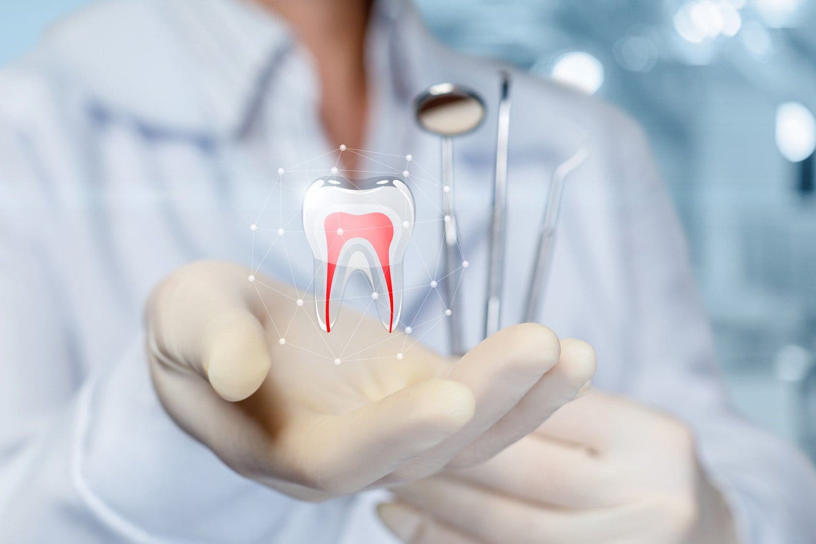 Endodonție – Tratament de canal