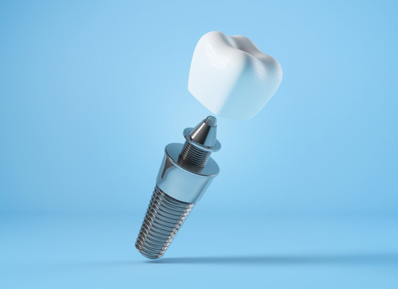 Implant dentar